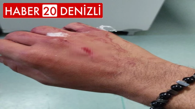 Motokuryerler ile dönerci arasında park yeri tartışması: 2 yaralı