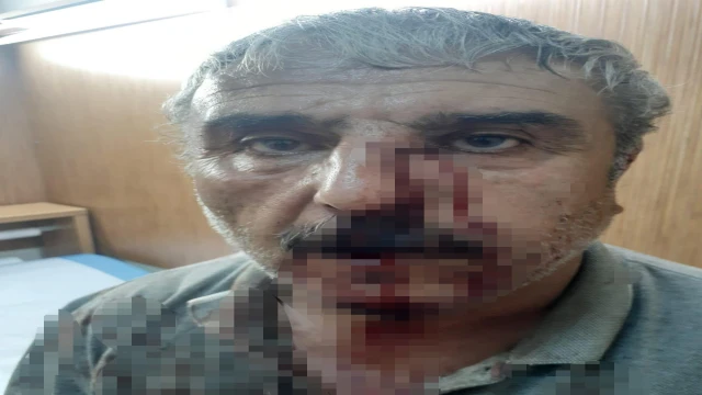 Doktor ile emekli öğretmenin mesai kavgası karakolda bitti