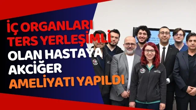 İç organları ters yerleşimli olan hastaya akciğer ameliyatı yapıldı