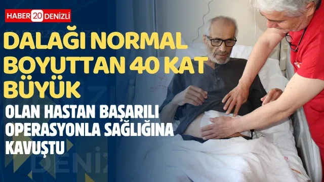 Dalağı normal boyuttan 40 kat büyük olan hastan başarılı operasyonla sağlığına kavuştu