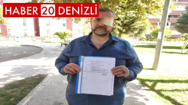 Tarihi geçmiş döner satmayı reddeden şef hem gözünden hem de işinden oldu