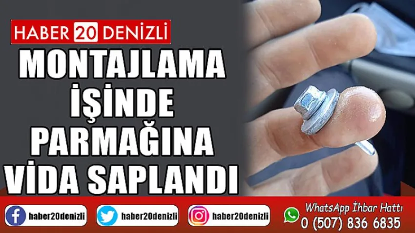 Montajlama İşinde Parmağına Vida Saplandı