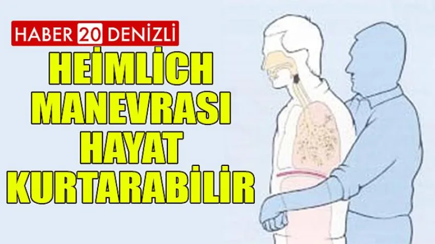 Heımlıch Manevrası Hayat Kurtarabilir