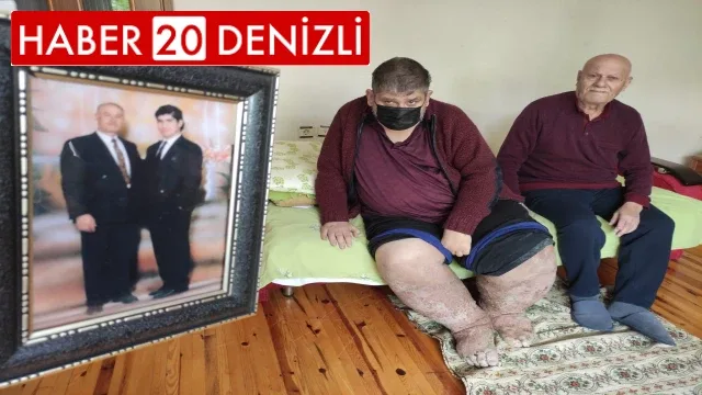 Sivrisinek, güvenlik görevlisinin hayatını kararttı