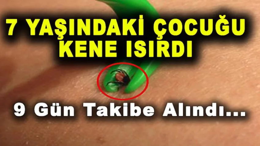7 Yaşındaki Çocuğu Kene Isırdı