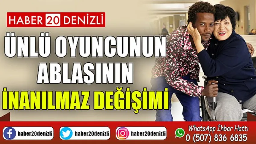 Ünlü oyuncunun ablasının inanılmaz değişimi