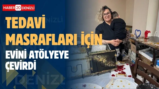Oğlunun tedavi masrafları için evini atölyeye çevirdi
