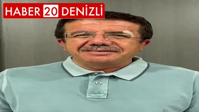 Kazada yaralanan eski Bakan Zeybekci: "Şu anda gayet iyi durumdayız"