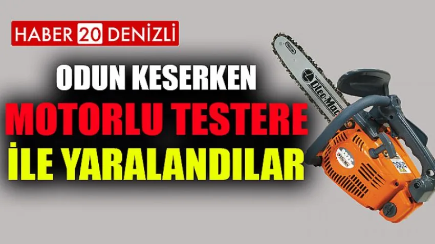 Odun Keserken Motorlu Testere ile Yaralandılar