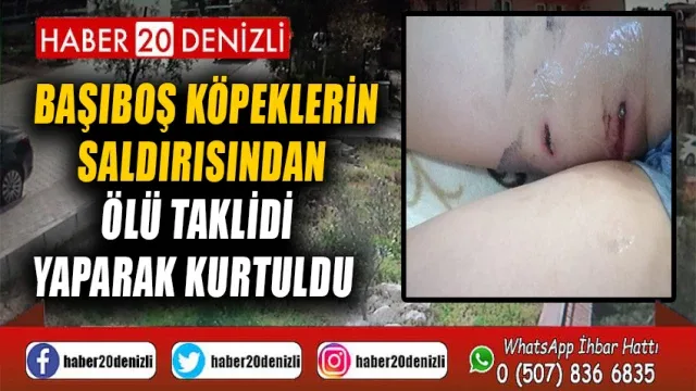Başıboş köpeklerin saldırısından ölü taklidi yaparak kurtuldu
