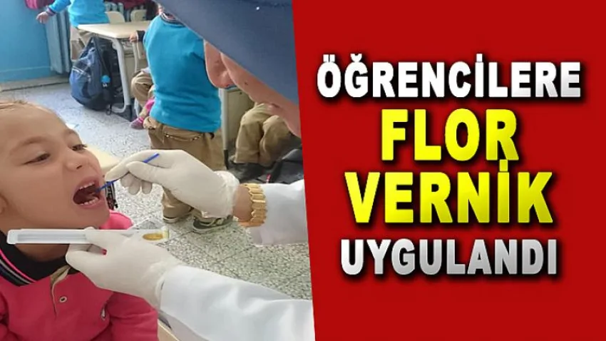 Öğrencilere Flor Vernik Uygulandı