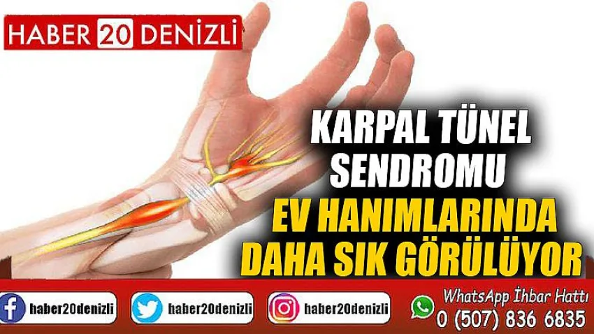 Karpal Tünel sendromu ev hanımlarında daha sık görülüyor