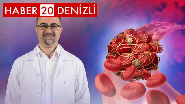 Tromboz hastalığı kanserin işareti olabilir