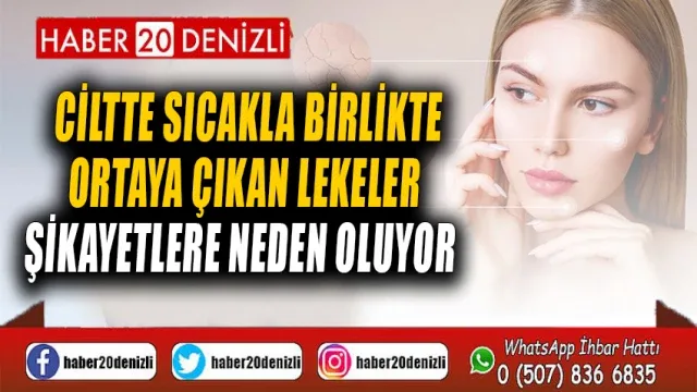 Ciltte sıcakla birlikte ortaya çıkan lekeler şikayetlere neden oluyor
