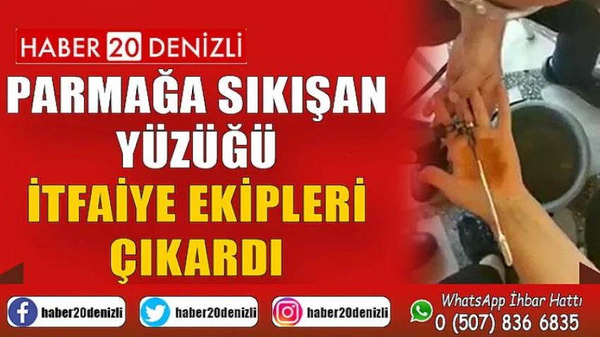 Parmağa sıkışan yüzüğü itfaiye ekipleri çıkardı
