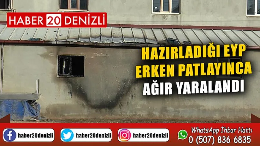 Hazırladığı EYP erken patlayınca ağır yaralandı