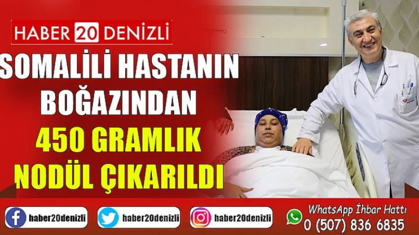 Somalili hastanın boğazından 450 gramlık nodül çıkarıldı