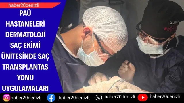PAÜ Hastaneleri Dermatoloji Saç Ekimi Ünitesinde Saç Transplantasyonu Uygulamaları