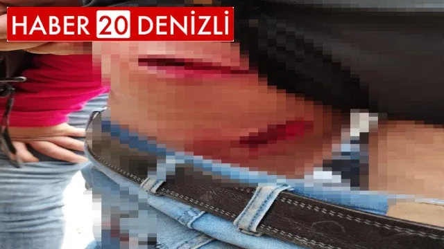 Yaban domuzunun saldırısına uğrayan avcı ölümden döndü