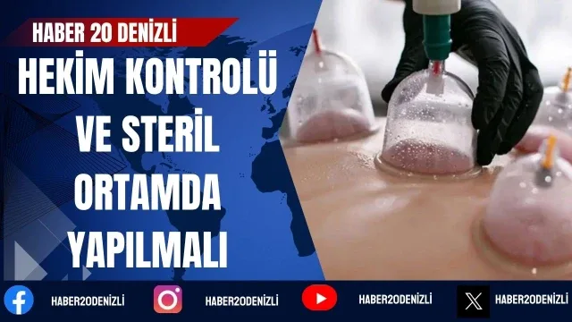Hacamat uygulamasında hekim kontrolü ve steril ortamda yapılmalı