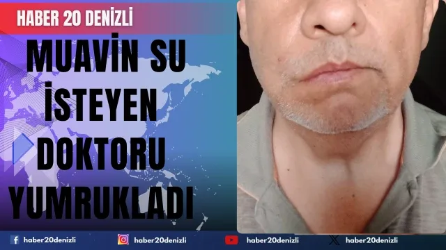 Pamukkale Turizm muavini su isteyen doktoru yumrukladı
