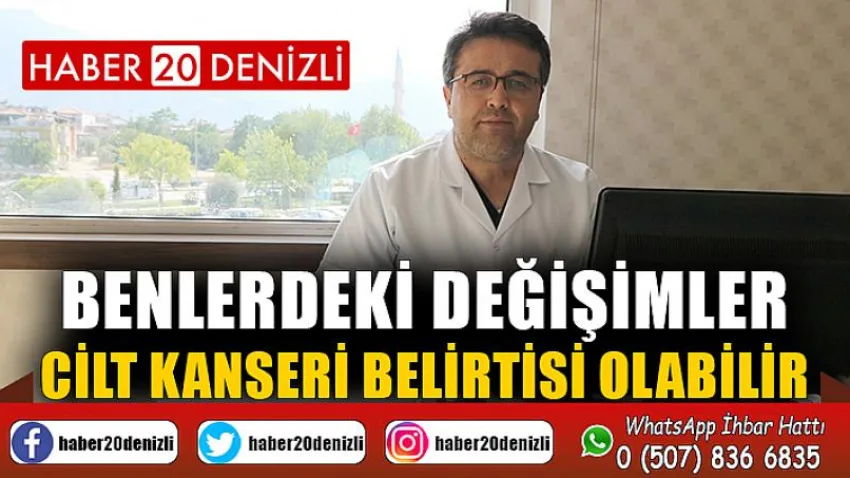 Benlerdeki değişimler cilt kanseri belirtisi olabilir