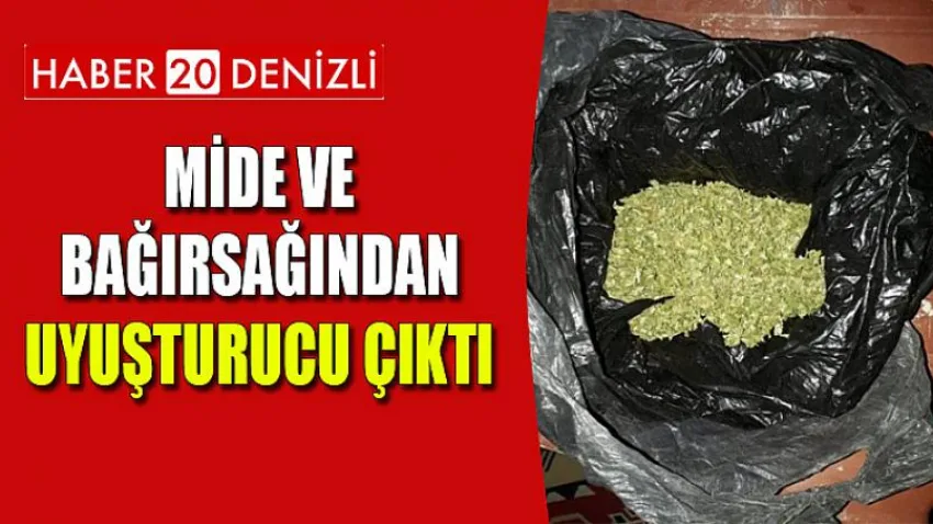 Mide ve Bağırsağından Uyuşturucu Çıktı